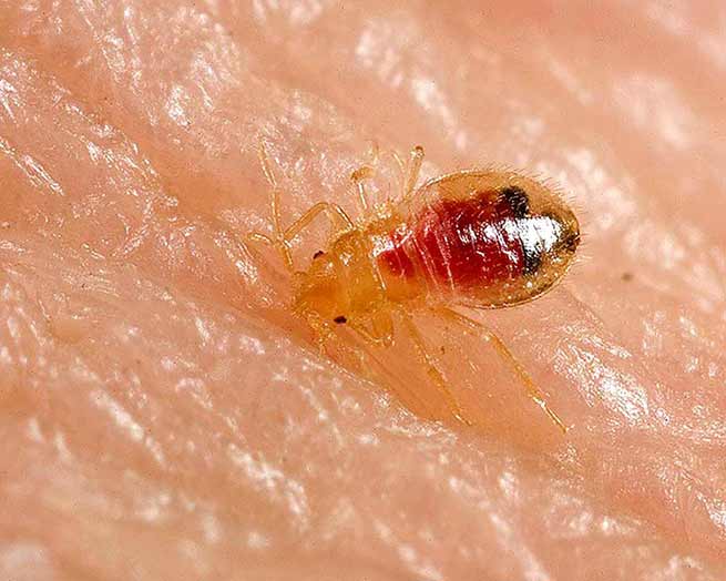 bed bug treatment